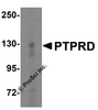 Western blot analysis of PTPRD in HeLa cell lysate with PTPRD antibody at 1 &#956;g/mL.