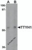 Western blot analysis of TTYH1 in Raji cell lysate with TTYH1 antibody at (A) 1 and (B) 2 &#956;g/mL.