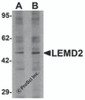 Western blot analysis of LEMD2 in 293 cell lysate with LEMD2 antibody at (A) 1 and (B) 2 &#956;g/mL.