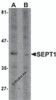 Western blot analysis of SEPT1 in Raji cell lysate with SEPT1 antibody at 1 &#956;g/ml in (A) the absence and (B) the presence of blocking peptide.