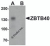 Western blot analysis of ZBTB40 in Raji cell lysate with ZBTB40 antibody at 0.5 &#956;g/ml in (A) the absence and (B) the presence of blocking peptide.