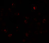 Immunofluorescence of ZBTB40 in Raji cells with ZBTB40 antibody at 20 ug/mL.