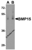 Western blot analysis of BMP15 in human testis tissue lysate with BMP15 antibody at (A) 1 and (B) 2 &#956;g/mL.