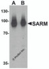 Western blot analysis of SARM in Daudi cell lysate with SARM antibody at (A) 1 and (B) 2 &#956;g/mL.