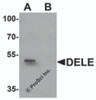 Western blot analysis of DELE in rat brain tissue lysate with DELE antibody at 1 &#956;g/ml in (A) the absence and (B) the presence of blocking peptide.
