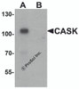 Western blot analysis of CASK in mouse brain tissue lysate with CASK antibody at 1 &#956;g/ml in (A) the absence and (B) the presence of blocking peptide.