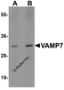 Western blot analysis of VAMP7 in mouse lung tissue lysate with VAMP7 antibody at (A) 0.5 and (B) 1 &#956;g/mL.