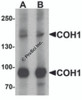 Western blot analysis of COH1 in SK-N-SH cell lysate with COH1 antibody at (A) 1 and (B) 2 &#956;g/mL.