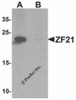 Western blot analysis of ZF21 in 3T3 cell tissue lysate with ZF21 antibody at 1 &#956;g/ml in (A) the absence and (B) the presence of blocking peptide.