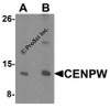 Western blot analysis of CENPW in HeLa cell lysate lysate with CENPW antibody at (A) 0.5 and (B) 1 &#956;g/mL.