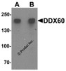 Western blot analysis of DDX60 in A20 cell lysate with DDX60 antibody at (A) 1 and (B) 2 &#956;g/mL.