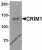 Western blot analysis of CRIM1 in Jurkat cell lysate with Crim1 antibody at 1 &#956;g/mL.