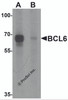 Western blot analysis of BCL6 in rat lung tissue lysate with Bcl6 antibody at 1 &#956;g/ml in (A) the absence and (B) the presence of blocking peptide