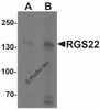 Western blot analysis of RGS22 in Jurkat cell lysate with RGS22 antibody at (A) 1 and (B) 2 &#956;g/mL.