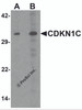 Western blot analysis of CDKN1C in 293 cell lysate with CDKN1C antibody at (A) 1 and (B) 2 &#956;g/mL.