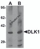 Western blot analysis of HepG2 in 293 cell lysate with DLK1 antibody at (A) 1 and (B) 2 &#956;g/mL.