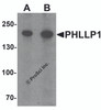 Western blot analysis of PHLPP1 in SW480 cell lysate with PHLPP1 antibody at (A) 1 and (B) 2 &#956;g/mL.
