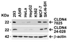 Figure 1 Independent Antibody Validation (IAV) via Protein Expression Profile in Human Cell Lines
Loading: 15 &#956;g of lysates per lane.
Antibodies: CLAUDIN4, 7025 (1 &#956;g/mL) , CLAUDIN4, 24-028 (1 &#956;g/mL) , and beta-actin (1 &#956;g/mL) , 1h incubation at RT in 5% NFDM/TBST.
Secondary: Goat anti-rabbit IgG HRP conjugate at 1:10000 dilution.