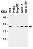 Figure 2 Western Blot Validation in Human Cell Lines
Loading: 15 ug of lysates per lane.
Antibodies: CLAUDIN4, 7025 (1 ug/mL) , 1h incubation at RT in 5% NFDM/TBST.
Secondary: Goat anti-rabbit IgG HRP conjugate at 1:10000 dilution.