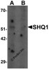 Western blot analysis of SHQ1 in human heart tissue lysate with SHQ1 antibody at 1 &#956;g/mL in (A) the absence and (B) the presence of blocking peptide.