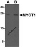 Western blot analysis of MYCT1 in rat lung tissue lysate with MYCT1 antibody at (A) 1 and (B) 2 &#956;g/mL.