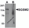 Western blot analysis of SGSM2 in human cerebellum tissue lysate with SGSM2 antibody at 1 &#956;g/ml in (A) the absence and (B) the presence of blocking peptide