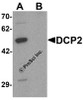 Western blot analysis of DCP2 in 293 cell lysate with DCP2 antibody at 1 &#956;g/mL in (A) the absence and (B) the presence of blocking peptide.