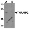 Western blot analysis of TNFAIP2 in K562 cell lysate with TNFAIP2 antibody at 1 &#956;g/mL in (A) the absence and (B) the presence of blocking peptide.