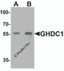 Western blot analysis of GHDC in 293 cell lysate with GHDC antibody at (A) 0.5 and (B) 1 &#956;g/mL.