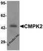 Western blot analysis of CMPK2 in rat lung tissue lysate with CMPK2 antibody at 1 &#956;g/mL
