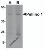 Western blot analysis of Pellino 1 in human liver tissue lysate with Pellino 1 antibody at (A) 1 and (B) 2 &#956;g/mL.