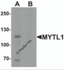 Western blot analysis of MYT1L in mouse brain tissue lysate with MYT1L antibody at 1 &#956;g/mL in (A) the absence and (B) the presence of blocking peptide.