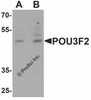 Western blot analysis of POU3F2 in 3T3 cell lysate with POU3F2 antibody at (A) 1 and (B) 2 &#956;g/mL.