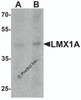 Western blot analysis of LMX1A in rat brain tissue lysate with LMX1A antibody at (A) 1 and (B) 2 &#956;g/mL.