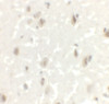 Immunohistochemistry of LMX1A in human brain tissue with LMX1A antibody at 2.5 ug/mL.