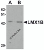 Western blot analysis of LMX1B in A-20 cell lysate with LMX1B antibody at (A) 1 and (B) 2 &#956;g/mL.