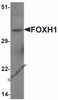 Western blot analysis of FOXH1 in human liver tissue lysate with FOXH1 antibody at 1 &#956;g/mL.