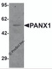 Western blot analysis of PANX1 in human ovary tissue lysate with PANX1 antibody at 1 &#956;g/mL.