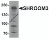 Western blot analysis of SHROOM3 in SK-N-SH cell lysate with SHROOM3 antibody at 1 &#956;g/mL.