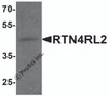 Western blot analysis of RTN4RL2 in rat brain tissue lysate with RTN4RL2 antibody at 1 &#956;g/mL.