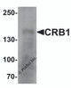 Western blot analysis of CRB1 in human small intestine Tissue lysate with CRB1 antibody at 1 &#956;g/mL.