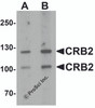 Western blot analysis of CRB2 in rat brain tissue lysate with CRB2 antibody at (A) 0.5 and (B) 1 &#956;g/mL