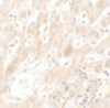 Immunohistochemistry of DHX36 in human liver tissue with DHX36 antibody at 5 ug/mL.