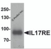 Western blot analysis of IL-17RE in human ovary tissue lysate with IL-17RE antibody at 1 &#956;g/mL.