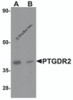 Western blot analysis of PTGDR2 in small intestine tissue lysate with PTGDR2 antibody at 1 &#956;g/mL in (A) the absence and (B) the presence of blocking peptide.