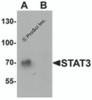 Western blot analysis of STAT3 in human small intestine tissue lysate with STAT3 antibody at 1 &#956;g/mL in (A) the absence and (B) the presence of blocking peptide.
