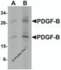 Western blot analysis of PDGF-B in rat liver tissue lysate with PDGF-B antibody at (A) 1 and (B) 2 &#956;g/mL.