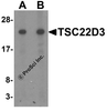 Western blot analysis of TSC22D3 in human small intestine tissue lysate with TSC22D3 antibody at (A) 1 and (B) 2 &#956;g/mL.