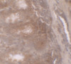 Immunohistochemistry of TSC22D3 in human small intestine tissue with TSC22D3 antibody at 5 ug/ml.