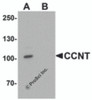 Western blot analysis of CCNT1 in rat brain tissue lysate with CCNT1 antibody at 1 &#956;g/mL in (A) the absence and (B) the presence of blocking peptide.